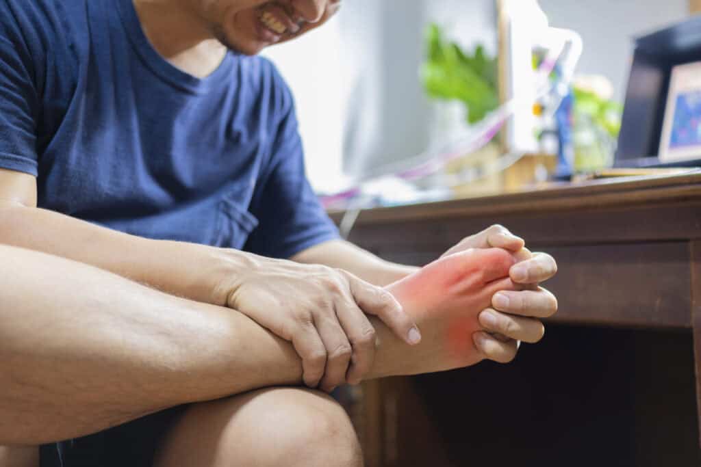 7 Mitos dan Fakta Asam Urat