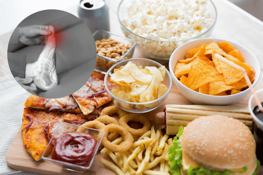 Ultraproses Food Lebih Berbahaya untuk Asam Urat