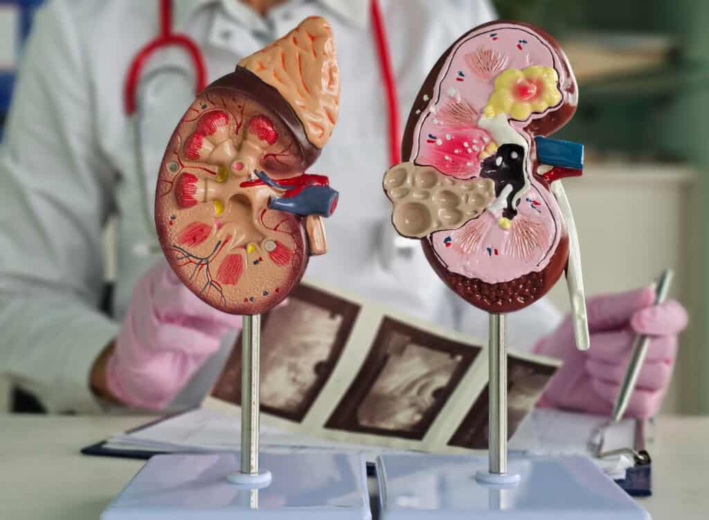 Hati dan ginjal bekerja lebih keras jika konsumsi protein saja tanpa jenis makanan lain